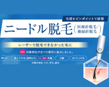 ニードル脱毛